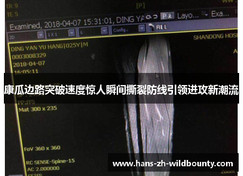 康瓜边路突破速度惊人瞬间撕裂防线引领进攻新潮流